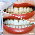 Teeth Whitening Stain Eraser